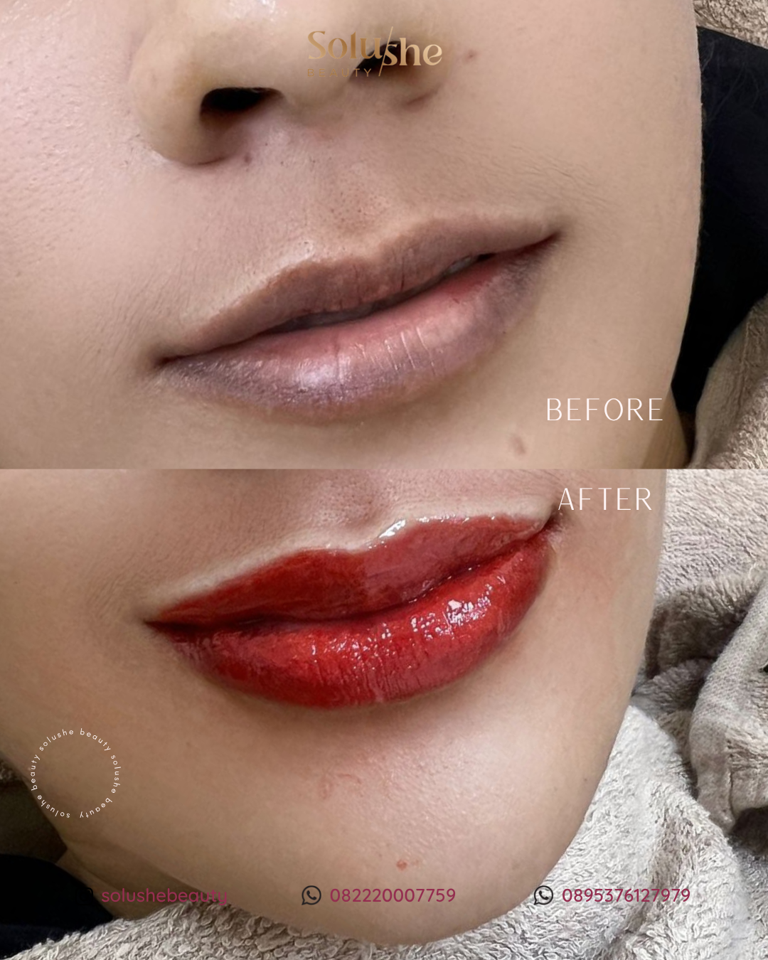 Hasil nyata before after Sulam Bibir by Senior Artist Solushe